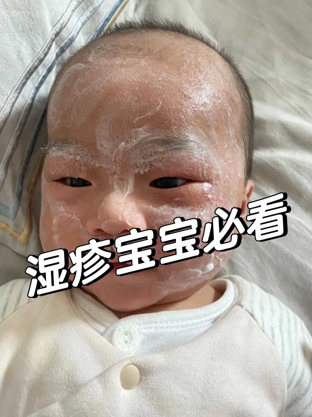 地贫做第三代试管都要准备什么才能做?